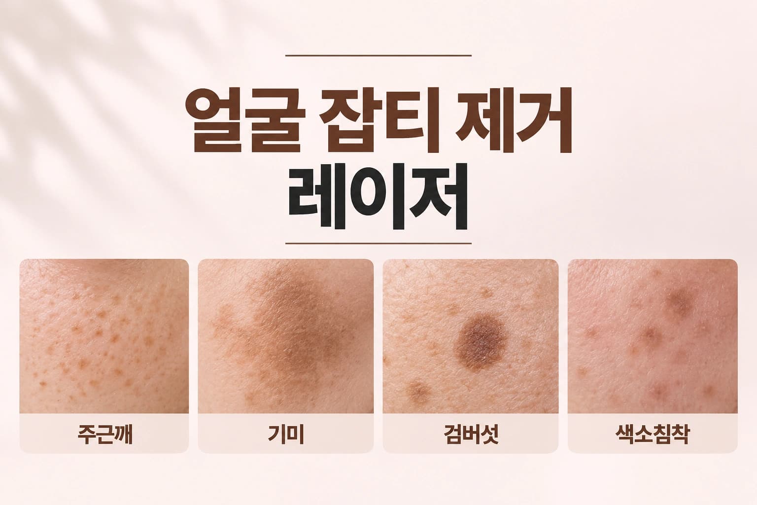 얼굴 잡티 제거 레이저 원리와 종류, 권장횟수 안내