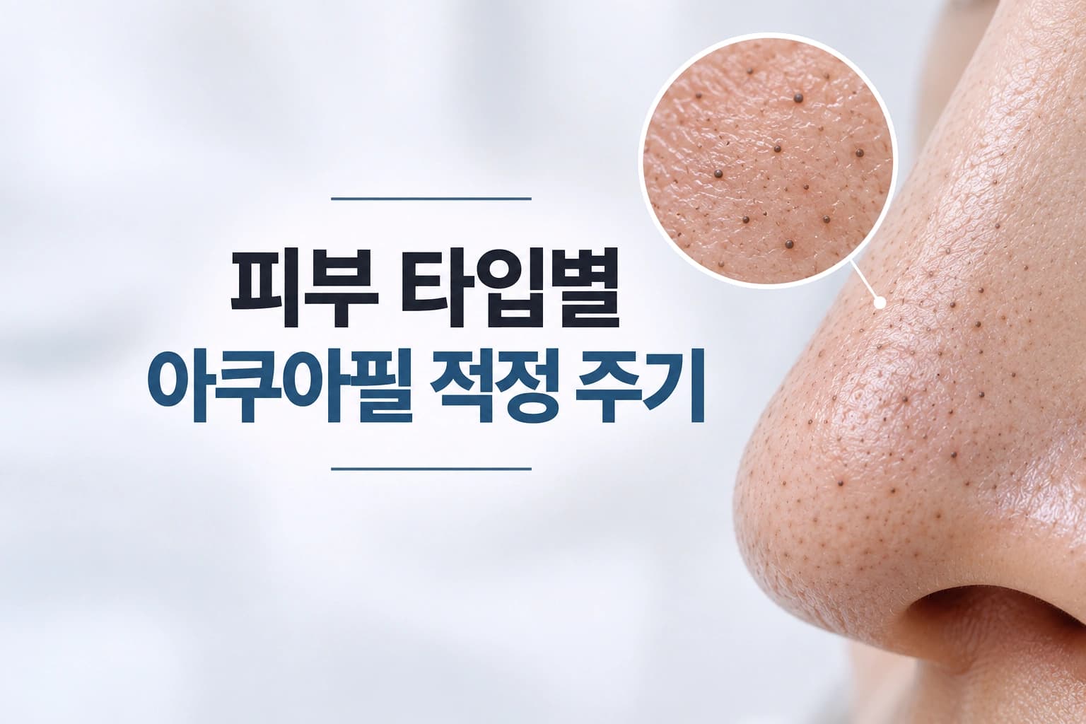 아쿠아필 효과와 피부 타입에 따라 달라지는 시술 주기를 안내